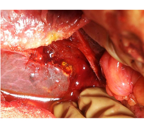 Separate R & L ducts
